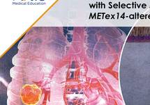 Practice Changes Advances with Selective MET Inhibitors in METex14-altered NSCLC